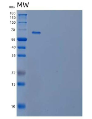 Recombinant Human Cyr61/CCN1 Protein(C-Fc),Recombinant Human Cyr61/CCN1 Protein(C-Fc)