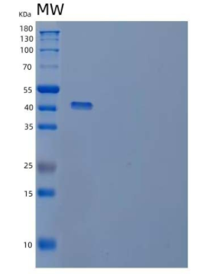 Recombinant Human Peptidyl-Prolyl Cis-Trans Isomerase D/PPID/PPIase D Protein(N, C-6His),Recombinant Human Peptidyl-Prolyl Cis-Trans Isomerase D/PPID/PPIase D Protein(N, C-6His)