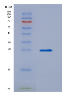 Eukaryotic Interleukin 17 (IL17),Eukaryotic Interleukin 17 (IL17)