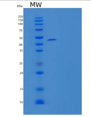 Recombinant Mouse Lymphotoxin β Receptor/LTBR/TNFRSF3/TNFRrp Protein(C-Fc),Recombinant Mouse Lymphotoxin β Receptor/LTBR/TNFRSF3/TNFRrp Protein(C-Fc)
