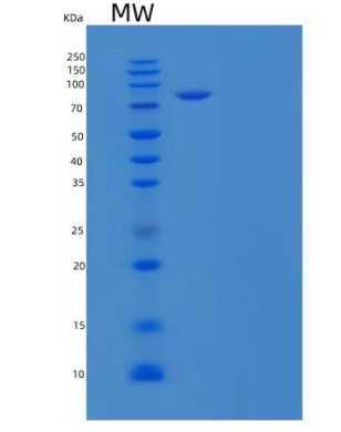 Recombinant Mouse PDGF R α/PDGFRA/CD140a Protein(C-Fc),Recombinant Mouse PDGF R α/PDGFRA/CD140a Protein(C-Fc)