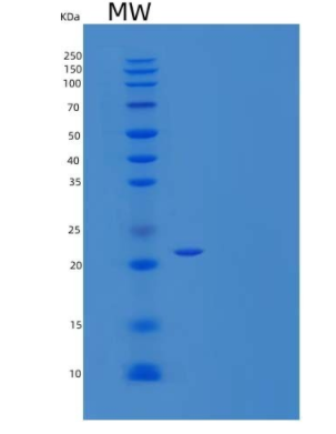 Recombinant Mouse RANK/TNFRSF11A Protein(C-6His),Recombinant Mouse RANK/TNFRSF11A Protein(C-6His)
