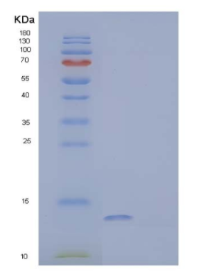 Recombinant Human Protein FAM19A4/FAM19A4 Protein(N-6His),Recombinant Human Protein FAM19A4/FAM19A4 Protein(N-6His)