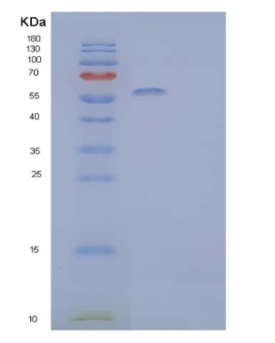 Recombinant Human α-Amylase 2B/AMY2B Protein(C-6His),Recombinant Human α-Amylase 2B/AMY2B Protein(C-6His)