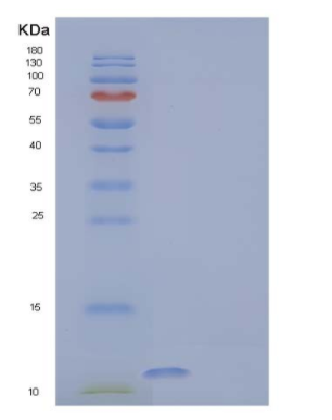 Recombinant Human Protein S100-A13 Protein,Recombinant Human Protein S100-A13 Protein