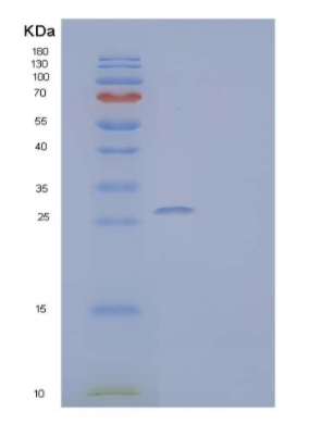 Recombinant Human Bisphosphoglycerate Mutase/BPGM Protein(C-6His),Recombinant Human Bisphosphoglycerate Mutase/BPGM Protein(C-6His)