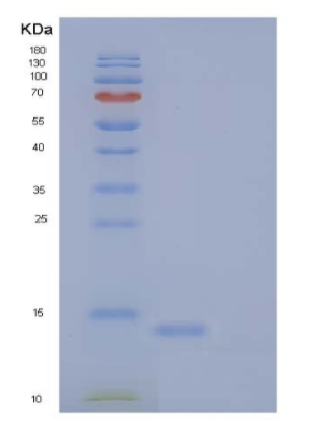 Recombinant Human BOC Protein/BOC Protein(C-6His),Recombinant Human BOC Protein/BOC Protein(C-6His)