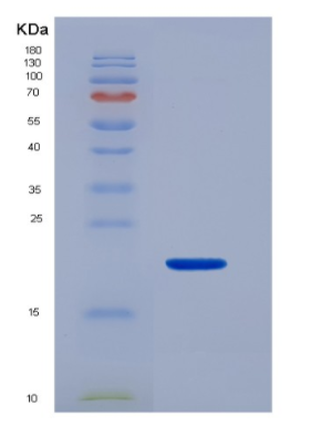 Recombinant Human CD16b / FCGR3B Protein, Biotinylated,Recombinant Human CD16b / FCGR3B Protein, Biotinylated
