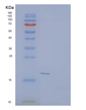 Recombinant Mouse Triggering Receptor Expressed on Myeloid Cells 2b/TREM-2b Protein(C-6His),Recombinant Mouse Triggering Receptor Expressed on Myeloid Cells 2b/TREM-2b Protein(C-6His)