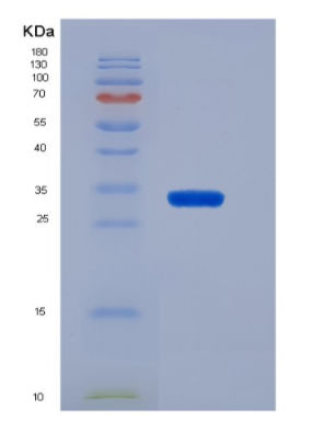 Recombinant Human CD19 / Leu-12 Protein (His tag),Recombinant Human CD19 / Leu-12 Protein (His tag)