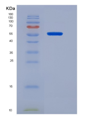 Recombinant Human CD19 Protein(C-Fc),Recombinant Human CD19 Protein(C-Fc)