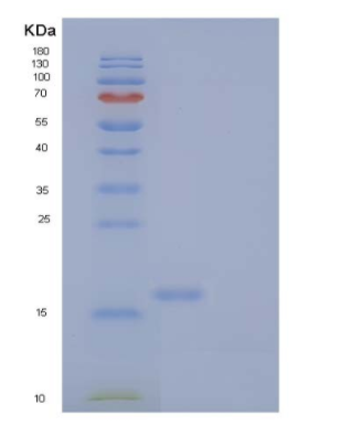 Recombinant Human NKG2-D type II Integral Membrane Protein,Recombinant Human NKG2-D type II Integral Membrane Protein