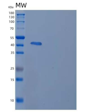 Recombinant Human Receptor Expressed in Lymphoid Tissues Protein,Recombinant Human Receptor Expressed in Lymphoid Tissues Protein