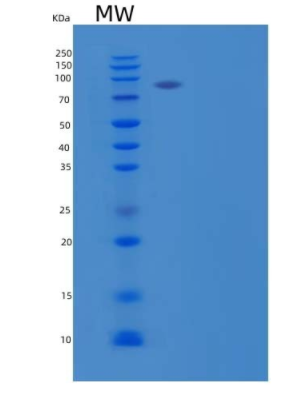 Recombinant Human Cadherin-11/OB-Cadherin/CDH11 Protein(C-Fc-6His),Recombinant Human Cadherin-11/OB-Cadherin/CDH11 Protein(C-Fc-6His)