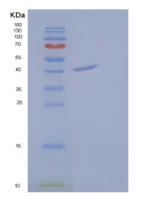 Recombinant Human Calreticulin-3/CALR3/CRT2 Protein,Recombinant Human Calreticulin-3/CALR3/CRT2 Protein