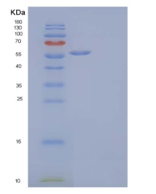 Recombinant Human MHC Class I Polypeptide-Related Sequence A/MICA Protein(C-Fc),Recombinant Human MHC Class I Polypeptide-Related Sequence A/MICA Protein(C-Fc)