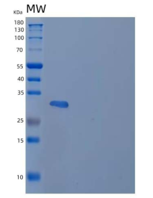 Recombinant Human Follistatin-Related Protein 1/FSTL1 Protein,Recombinant Human Follistatin-Related Protein 1/FSTL1 Protein