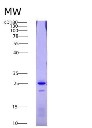 Eukaryotic Factor Related Apoptosis (FAS),Eukaryotic Factor Related Apoptosis (FAS)