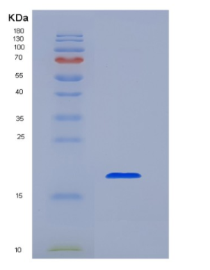 Eukaryotic Membrane Spanning 4 Domains Subfamily A, Member 1 (CD20),Eukaryotic Membrane Spanning 4 Domains Subfamily A, Member 1 (CD20)