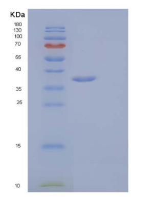 Recombinant Human Interleukin-1 receptor type 1/IL-1R-1 Protein,Recombinant Human Interleukin-1 receptor type 1/IL-1R-1 Protein