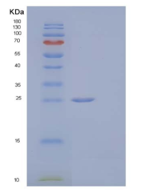 Recombinant Human Serpin B5/SERPINB5/Maspin Protein,Recombinant Human Serpin B5/SERPINB5/Maspin Protein