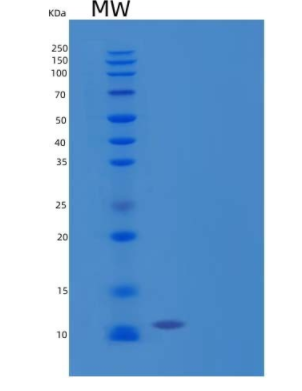 Recombinant Human C-C Motif Chemokine 24/CCL24/Eotaxin-2/MPIF-2 Protein(C-6His),Recombinant Human C-C Motif Chemokine 24/CCL24/Eotaxin-2/MPIF-2 Protein(C-6His)