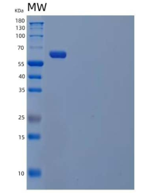 Recombinant Human Sialic Acid-Binding Ig-Like Lectin 9/Siglec 9/CD329 Protein(C-Fc),Recombinant Human Sialic Acid-Binding Ig-Like Lectin 9/Siglec 9/CD329 Protein(C-Fc)