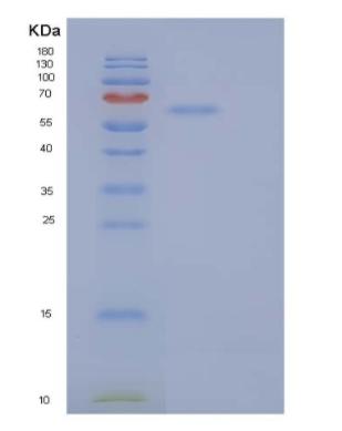 Recombinant Human Secretogranin-2/SCG2 Protein(C-6His),Recombinant Human Secretogranin-2/SCG2 Protein(C-6His)