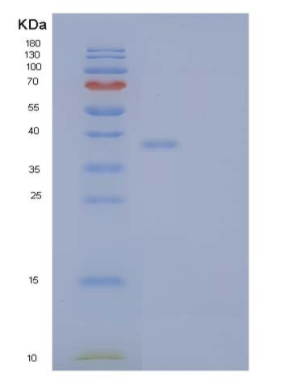 Recombinant Human Interleukin-1 receptor type 2/IL-1R-2 Protein,Recombinant Human Interleukin-1 receptor type 2/IL-1R-2 Protein