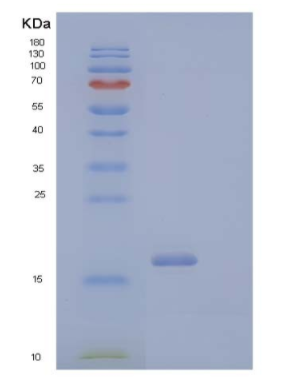 Recombinant Human CD40 Ligand/CD40L/TNFSF5 Protein,Recombinant Human CD40 Ligand/CD40L/TNFSF5 Protein