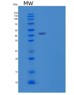 Recombinant Human CD40/TNFRSF5/CD40L Receptor Protein,Recombinant Human CD40/TNFRSF5/CD40L Receptor Protein