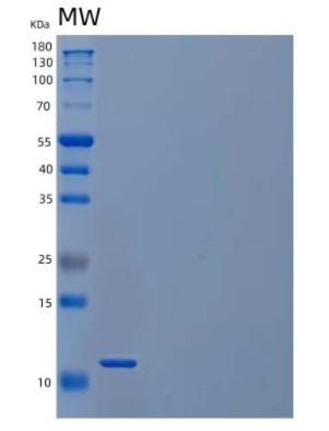 Recombinant Mouse C-C Motif Chemokine 21a/CCL21a//6CkineProtein,Recombinant Mouse C-C Motif Chemokine 21a/CCL21a//6CkineProtein