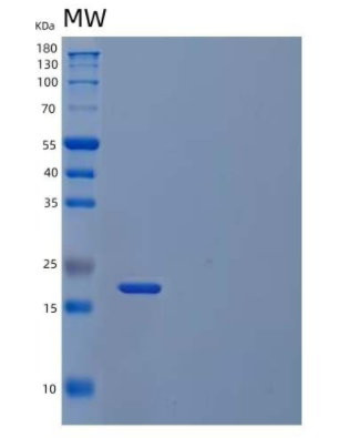 Recombinant Human SOD2/Mn-SOD Protein(C-6His, Cells),Recombinant Human SOD2/Mn-SOD Protein(C-6His, Cells)