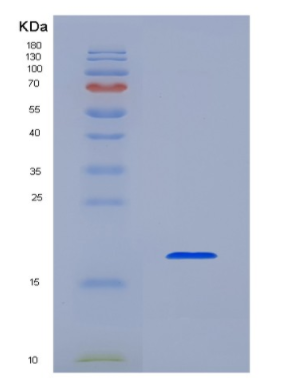 Recombinant Human Interleukin 1 Beta (IL1b),Recombinant Human Interleukin 1 Beta (IL1b)