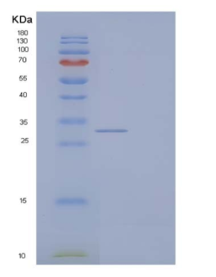 Recombinant Mouse Butyrophilin Subfamily 1 Member A1/BTN1A1 Protein(C-6His),Recombinant Mouse Butyrophilin Subfamily 1 Member A1/BTN1A1 Protein(C-6His)