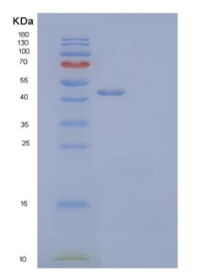 Recombinant Human CD44/MIC4 Protein(C-Fc),Recombinant Human CD44/MIC4 Protein(C-Fc)