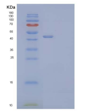 Recombinant Mouse Clusterin Protein,Recombinant Mouse Clusterin Protein