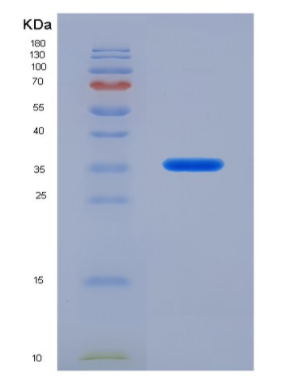 Recombinant Interleukin 21 (IL21),Recombinant Interleukin 21 (IL21)