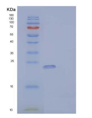 Recombinant Human Granulocyte Colony-Stimulating Factor/G-CSF Protein,Recombinant Human Granulocyte Colony-Stimulating Factor/G-CSF Protein