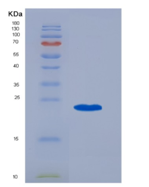 Recombinant Human CD20 / MS4A1 Protein (TrxA Tag),Recombinant Human CD20 / MS4A1 Protein (TrxA Tag)