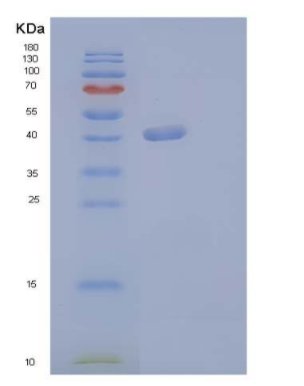 Recombinant Human G-CSF / CSF3 Protein (Fc tag),Recombinant Human G-CSF / CSF3 Protein (Fc tag)