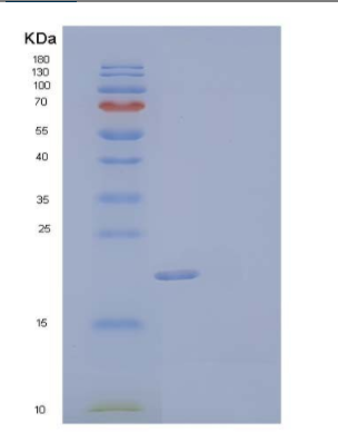 Recombinant Human SOD2/Mn-SOD Protein(N-6His),Recombinant Human SOD2/Mn-SOD Protein(N-6His)