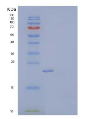 Recombinant Human Stathmin/STMN1 Protein(C-6His),Recombinant Human Stathmin/STMN1 Protein(C-6His)