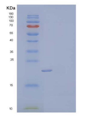 Recombinant Mouse C-X-C Motif Chemokine 16/CXCL16/SR-PSOX Protein(C-6His),Recombinant Mouse C-X-C Motif Chemokine 16/CXCL16/SR-PSOX Protein(C-6His)