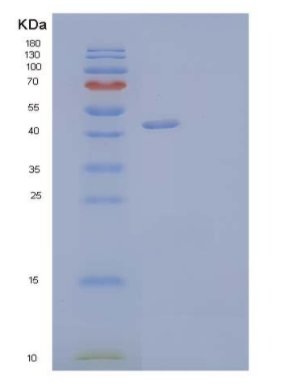 Recombinant Human Netrin-G1/NTNG1 Protein(C-6His),Recombinant Human Netrin-G1/NTNG1 Protein(C-6His)