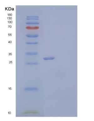 Recombinant Human Neurexophilin-1/NXPH1 Protein(C-6His),Recombinant Human Neurexophilin-1/NXPH1 Protein(C-6His)