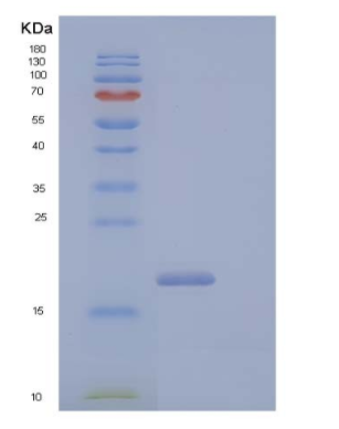 Recombinant Human CD99 Antigen-Like Protein 2/CD99L2 Protein(C-6His),Recombinant Human CD99 Antigen-Like Protein 2/CD99L2 Protein(C-6His)