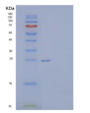 Recombinant Human Neuronal Acetylcholine Receptor Subunit β-3/CHRNB3 Protein(C-6His),Recombinant Human Neuronal Acetylcholine Receptor Subunit β-3/CHRNB3 Protein(C-6His)