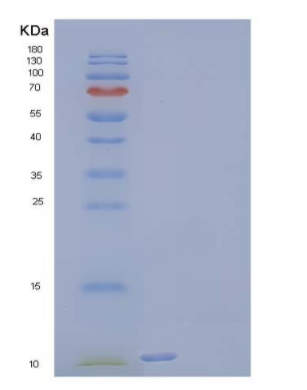 Recombinant Human Neurturin Protein,Recombinant Human Neurturin Protein