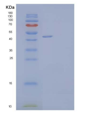 Recombinant Human Testin/TES Protein(C-6His),Recombinant Human Testin/TES Protein(C-6His)